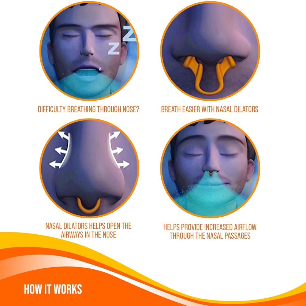 Nasal Dilators for Snoring - Anti Snore Nasal Dilator for Breathing - Upgraded Harder Version - Nose Breathing Aids - Nose Dilator for Sleep, Exercise - 4-Pack, 2 Small & 2 Medium - by Mobi Lock