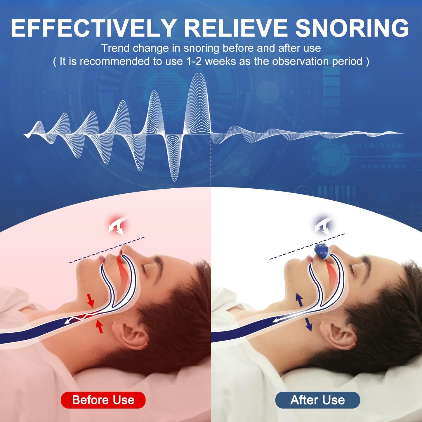 Anti Snore Device,Electric Stop Snoring Solution,Mini Portable Anti Snoring Devices Stopper,Adjustable Wind Speed Snoring Prevention Nasal Dilators for Men & Women Travel(Blue)