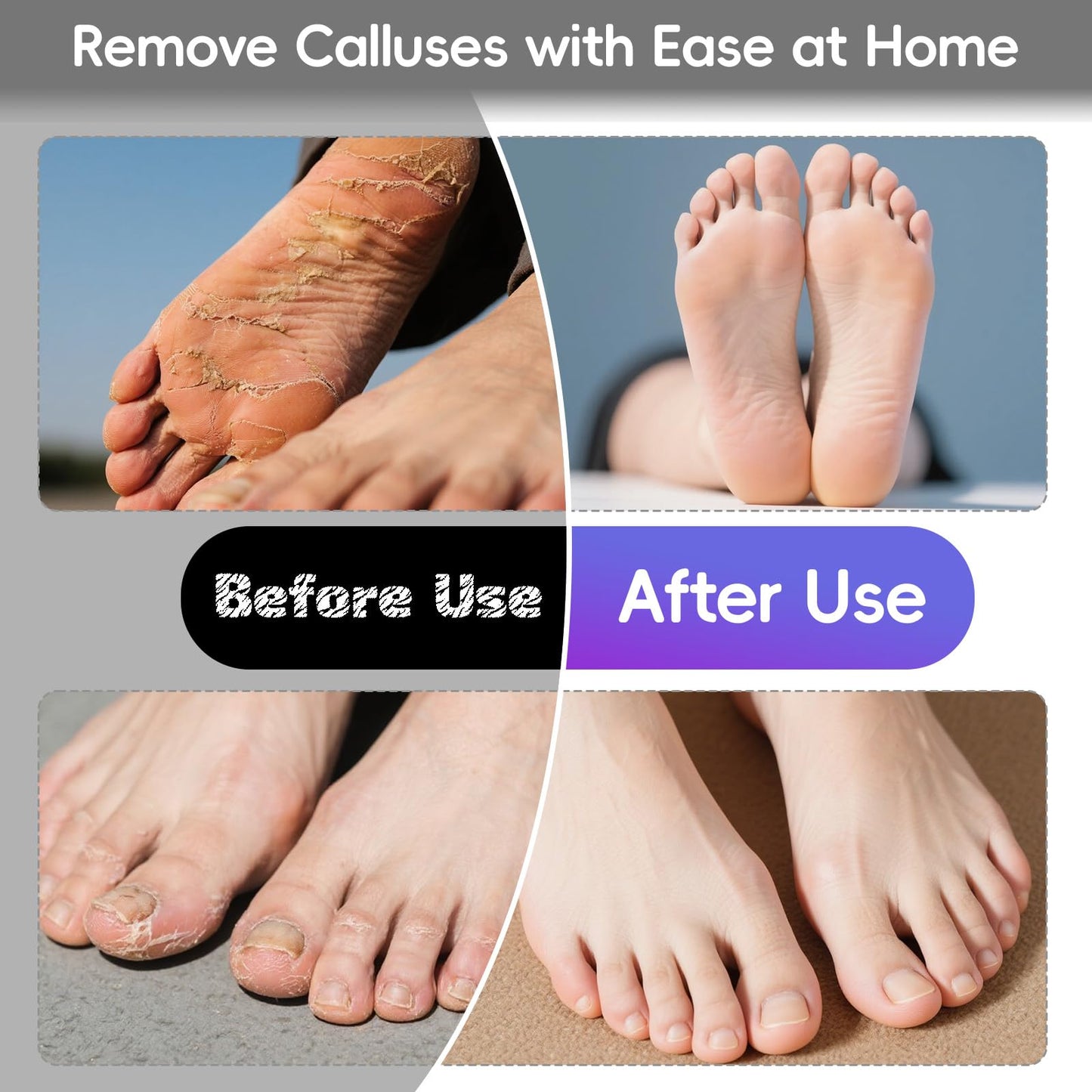StepLively Electric Foot Callus Remover, 4.7 Callus Remover for Feet with 60Pcs Sandpaper Discs, Foot Scrubber, Professional