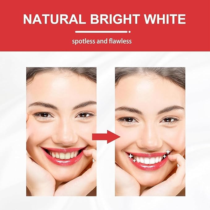 2 Pcs SP10 Probiotic Toothpaste - Ultra Whitening, Brightening, Fresh Breath & Deep Cleaning