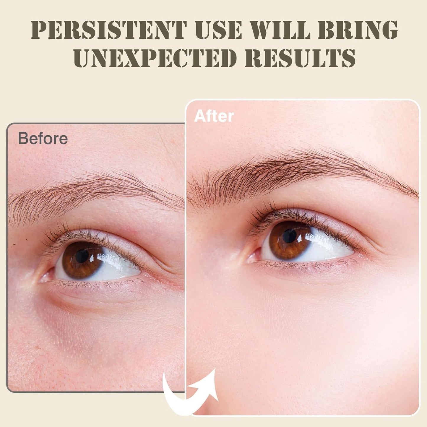 Under Eye Patches for Puffy Eyes and Dark Circles,60 Pcs Collagen Under Eye Mask Skin Care Products,Snail Mucin Eye Patches,Wrinkle Patches,Moisturise and Reduce Eye Lines To Revitalise You