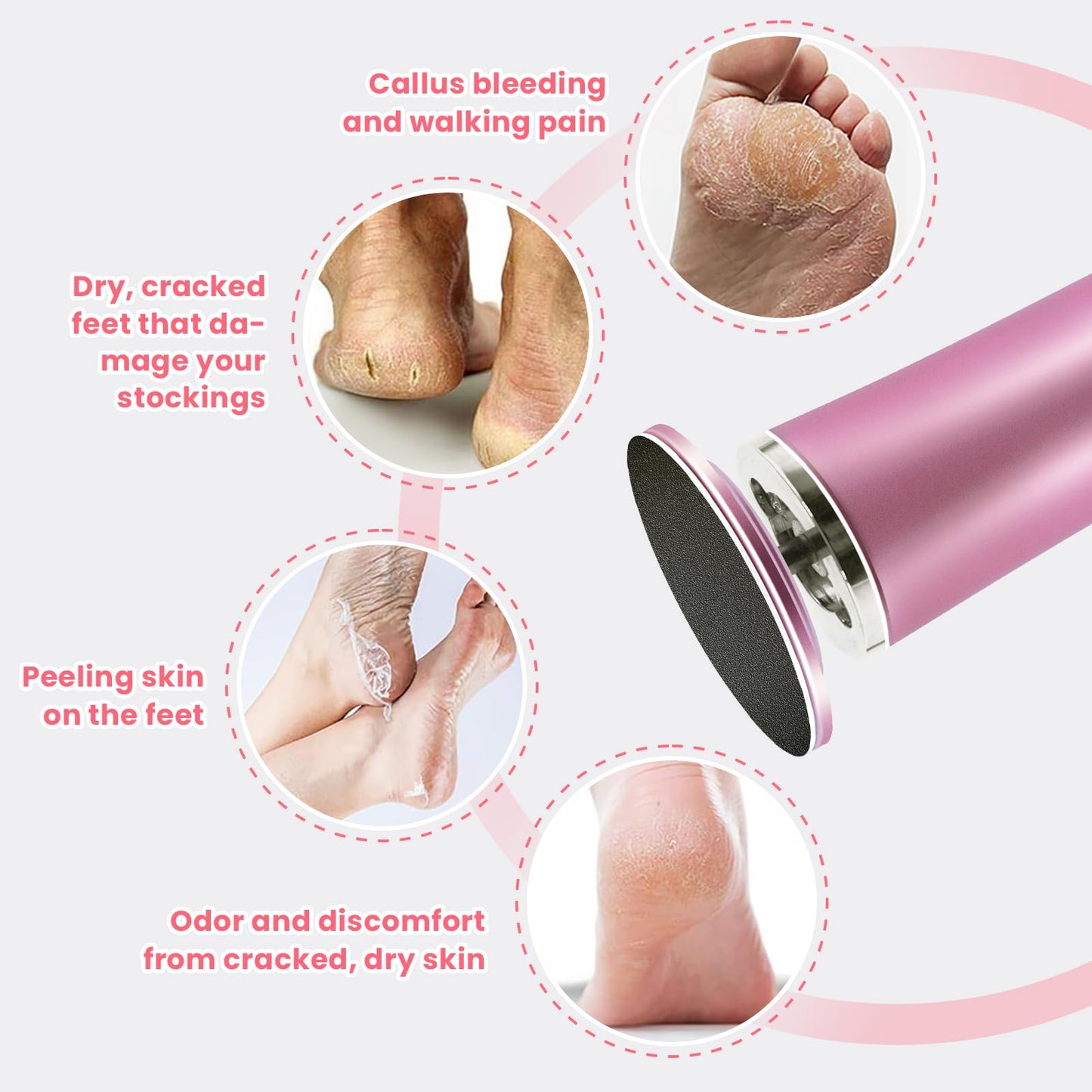 TAOMAND 60 Pcs Sandpaper Set 1.7'' x 1.7'' for Electric Foot Callus Remover,Pedicure Disc,Sander Discs Replace Set