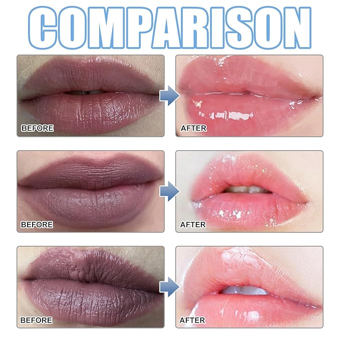 XIRUJNFD Lip Serum, Remove Dark Lips Pink Fresh Lightening Lips Treatment Lip Balm, Moisturizer Nourishing Essence Lips (2)