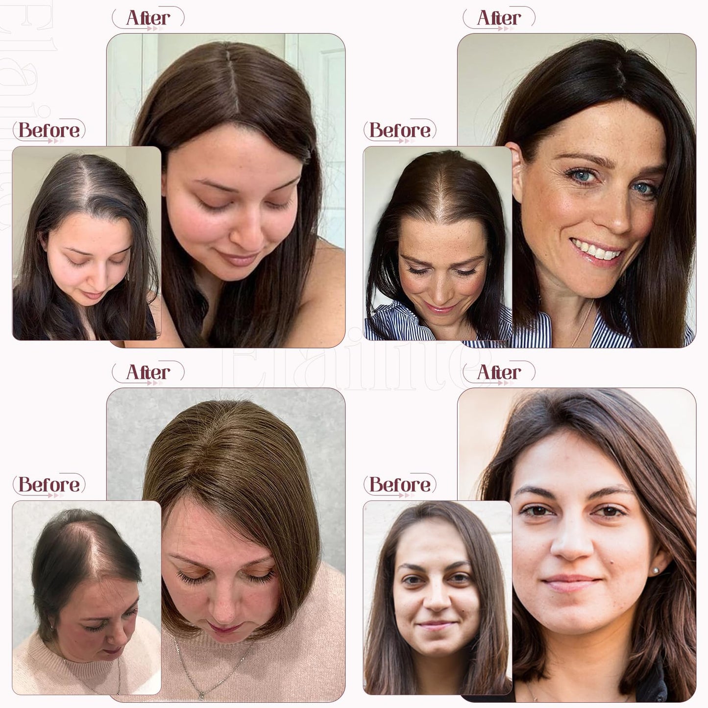 Elailite Hair Toppers for Women Real Human Hair Topper Thinning Thin 5.1x2.8 Silk Base Clip in Remy Hairpieces 10 Inch Natural B