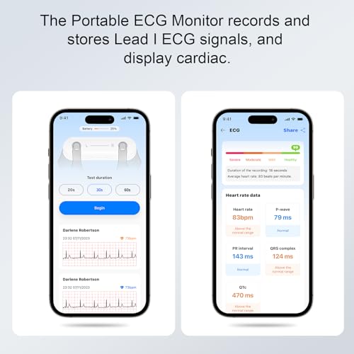 Monerr Portable ECG Monitor | Record and Store One-Lead ECG Signals | Monitor and Display Heart Rate for Home Health Care ...