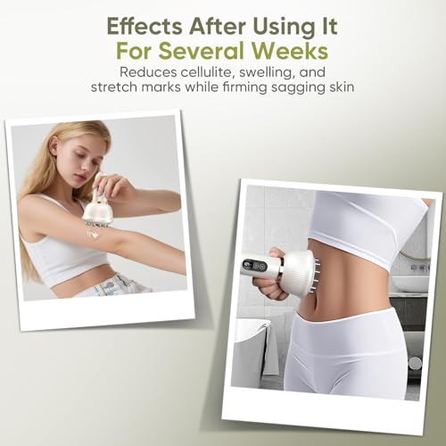 Lymphatic Drainage Massager & Anti-Cellulite Tool - Body Sculpting Machine with Microcurrent, Light, Heat & Vibration for ...