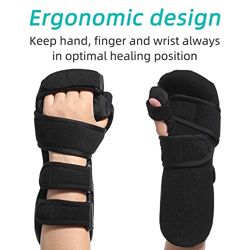 Fanwer Resting Hand Splint with Finger Separators - Hand Brace for Finger Contractures - Night Immobilizer Support for Car...