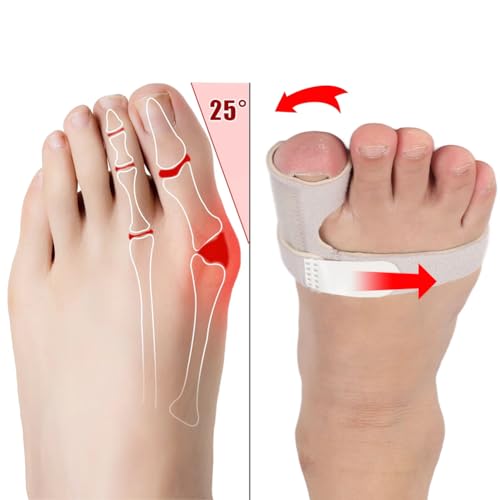 Joyzan Toe Brace Splint, Adjustable Orthopedic Corrector Big Toe Fracture Fixator Straightener Valgus Hammer Correction Pr...