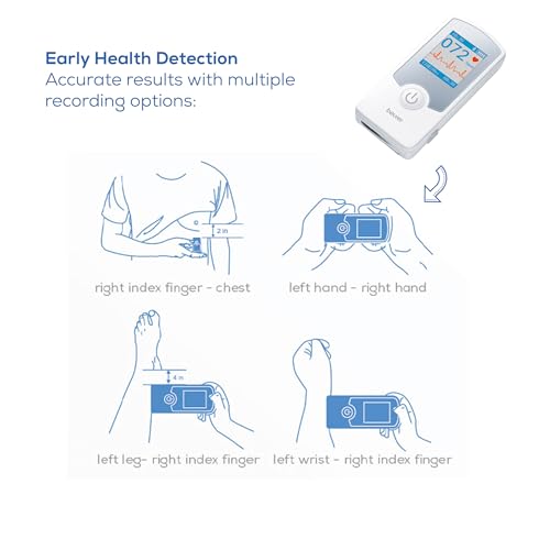 Beurer Cardio Companion EKG Monitor - 3-Lead Portable ECG Machine, Detects Irregular Heart Rhythms, Fast Results in 30 Sec...