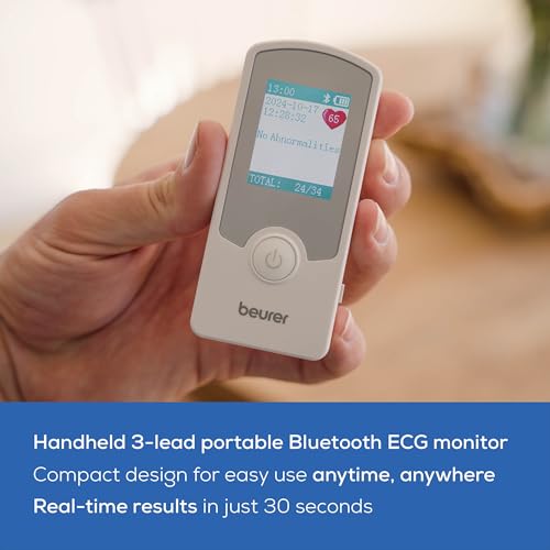 Beurer Cardio Companion EKG Monitor - 3-Lead Portable ECG Machine, Detects Irregular Heart Rhythms, Fast Results in 30 Sec...