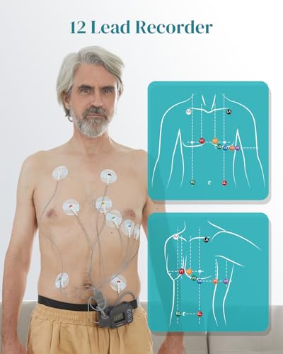 Livenpace Portable 12-Lead Heart Monitor with AI Analysis for Home Use, 24 Hours Recording, Stand-Alone Machine with LCD S...