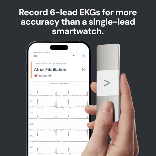 KardiaMobile 6L Max with 12-Month Subscription | 6-Lead Personal EKG Monitor | Heart Health Membership | Detects AFib & Ir...