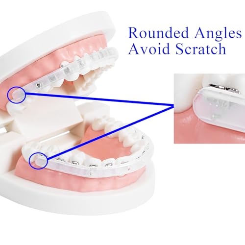 Comfort Cover for Braces, Lip Protector Mouth Guard Lip Cushion Teeth Shield Bumper for Brackets, Aligner, Dental Wax Alte...