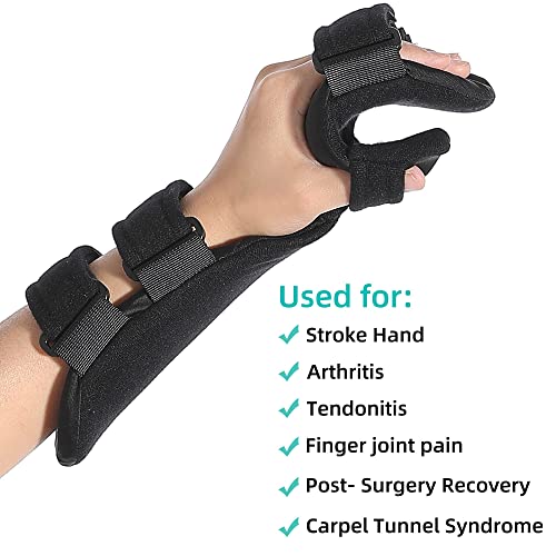 Fanwer Resting Hand Splint with Finger Separators - Hand Brace for Finger Contractures - Night Immobilizer Support for Car...