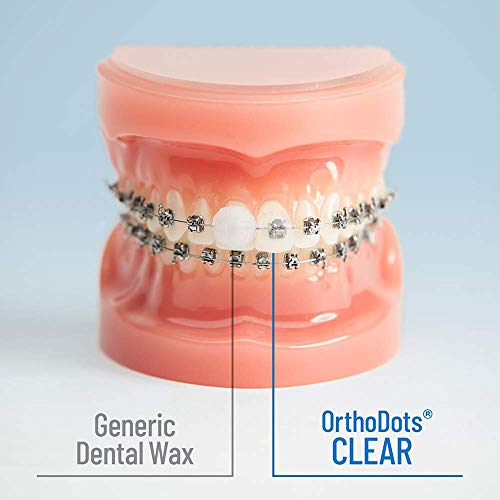 OrthoDots Clear – 24-Hour Protection | Sticks Better Than Dental Wax | Moisture Activated Braces Wax Alternative for Pain ...