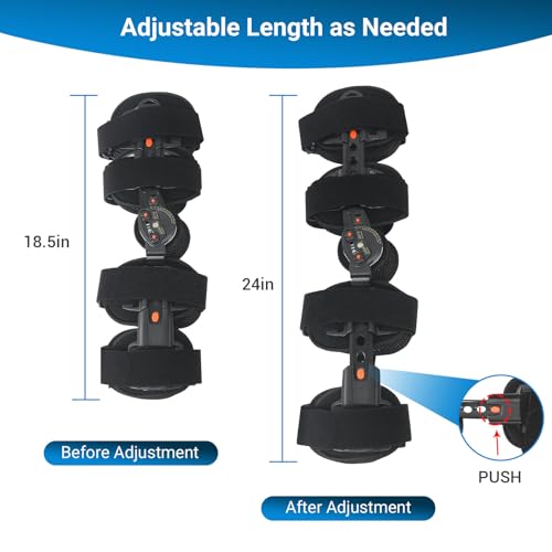 FocuBoody Hinged ROM Knee Brace,Unloader Knee Brace,Knee Immobilizer Brace,ACL, MCL and PCL Injury, Adjustable Orthopedic ...