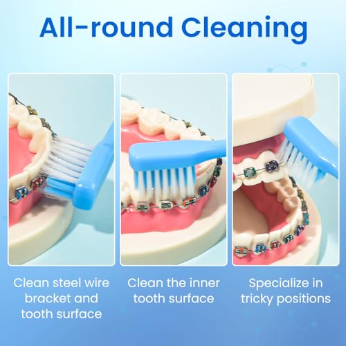 Y-Kelin V-Shaped Orthodontic Toothbrush for Braces Brackets 4 Count (Pack of 1) Soft Bristle with Inter Dental Brush