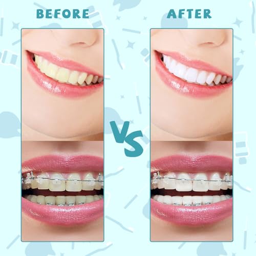 100PCS Interdental Brushes Between Teeth for Braces, Flossers Brush Cleaner, Orthodontic Flossers for Braces Cleaning Kit,...