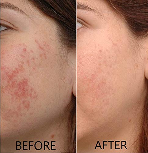 Vitamin C Serum 20% Pure L-Ascorbic Acid, Ferulic Acid, Vitamin E and HA and Hyaluronic Acid Serum with Vitamin B5 for Face and Eyes Natural Anti Aging Anti Wrinkle Set of 2 by Dr. Brenner