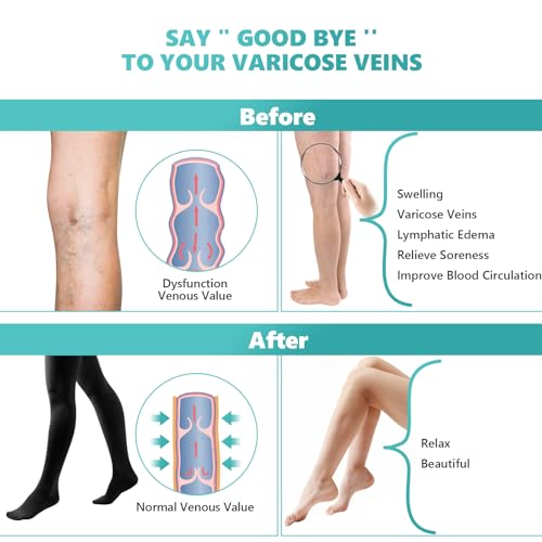 Compression Pantyhose Stockings for Women Men, 20-30 mmHg Medical Graduated Support Opaque Closed Toe Hose Tights