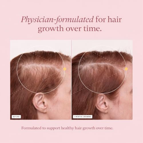GlowTrue Ashwagandha for Women with Biotin & Collagen – 500mg Female-Optimized Stress & Hormone Support, Hair Skin & Nails...