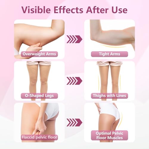 Thigh Trainer, 360°Adjustable Pelvic Floor Muscle Trainer with LED Display, Inner Thigh Exerciser with 20LB Resistance Ban...