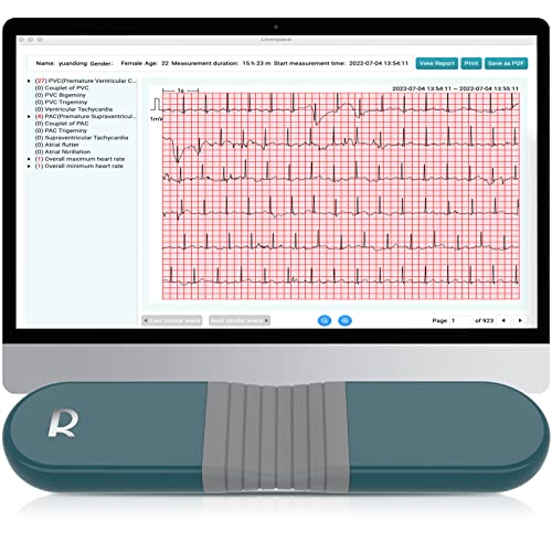 Livenpace 1-Lead Heart Health Monitor at Home, Portable 24 Hours Chest Lead Device with Free AI Analysis & PC Report, Rech...