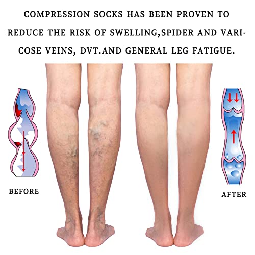 Lin Performance Medical Calf Compression Sleeve for Women and Men Lightweight Footless Socks for Nurses, Pregnant, Travel ...