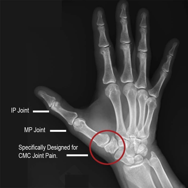 Comfort Cool Thumb CMC Restriction Splint. Patented Thumb Brace Provides Support and Compression. Helps with Arthritis, Te...