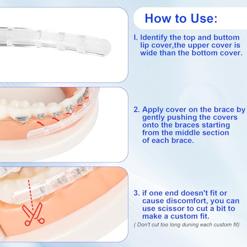 Comfort Cover for Braces - Lip Protector, Lip Cushion, Mouth Guard Clear Teeth Shield Bumper for Brackets, Aligner, Dental...