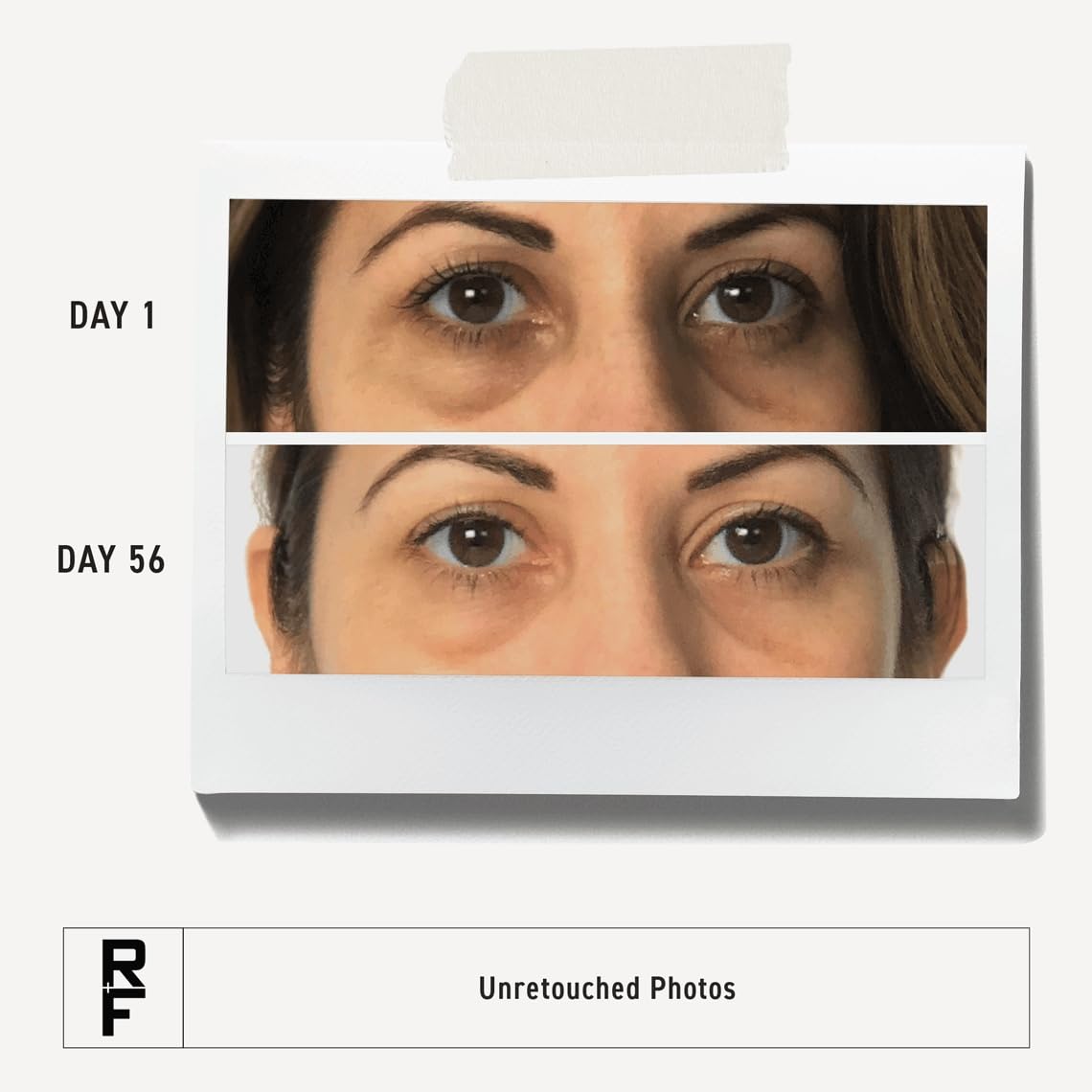RODAN + FIELDS Active Hydration Bright Eye Complex | 15ml | Moisturizing Under Eye Cream for Dry Skin | Eye Treatment for Refres