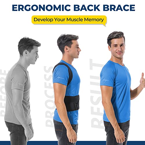 DIANMEI Back Brace Posture Corrector for Women and Men, Back Braces for Upper and Lower Back Pain Relief, Adjustable and F...