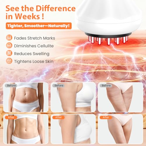 Body Sculpting Machine, Lymphatic Drainage Massager & Anti Cellulite Massage Tool, Helps Reduce Stretch Marks & Cellulite,...