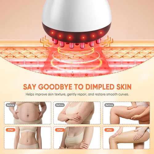 Lymphatic Drainage Massager & Anti Cellulite Massage Tool,Fascia Blaster for Cellulite,Helps Reduce Stretch Marks for Leg...