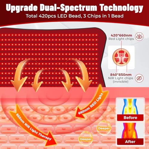 31.5''×24'' Red Light Therapy for Body, 41W 420LED Beads Wearable Red Infrared Light Therapy Wrap for Body, 660nm & 850nm,...