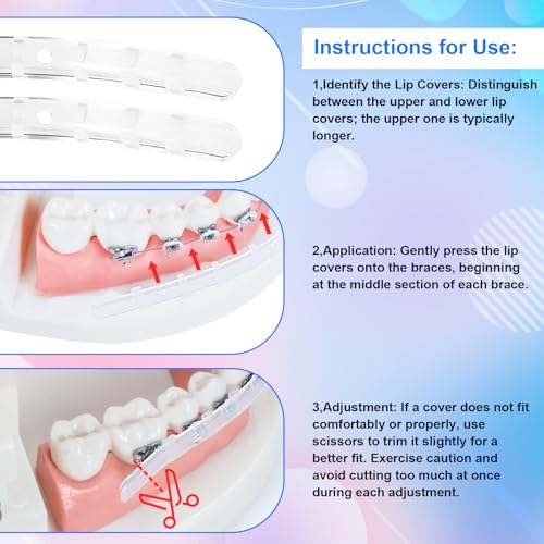 Comfort Cover for Braces, Lip Protector Mouth Guard Lip Cushion Teeth Shield Bumper for Brackets, Aligner, Dental Wax Alte...