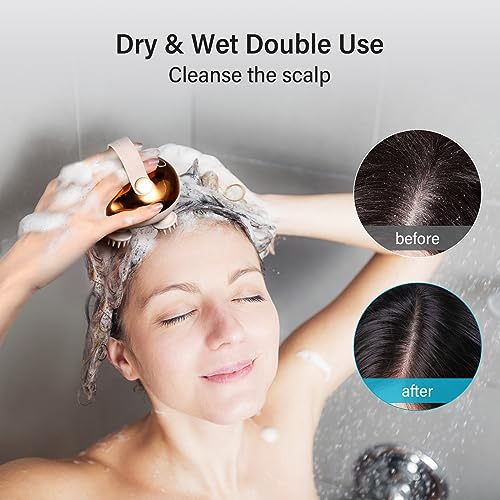 arboleaf Electric Scalp Massager Head Massager Scalp Stress Relax, 5 in 1 Kneading 128 Massage Nodes, Waterproof Hair Mass...