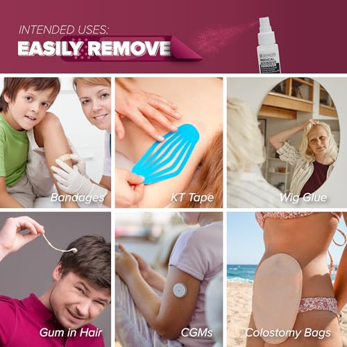 Skinister Medical Adhesive Remover for Skin | Wig, Ostomy, Tape, and Bandage Adhesive Remover | Silicone-Based, Hypoallergenic, Sting-Free | 4oz Spray