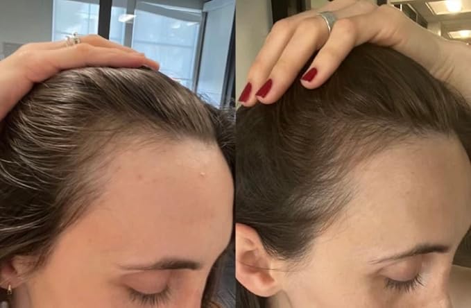 Growing Season Hair Growth And Repair Oil | With Burdock, Nettle Oil and Vitamin C for Visibly Fuller, Stronger and Shinier Hair.