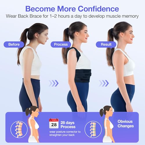 Kepwaa Posture Corrector for Women and Men, Full Back Brace Support, FSA&HSA Eligible, Adjustable Shoulder Straightener fo...