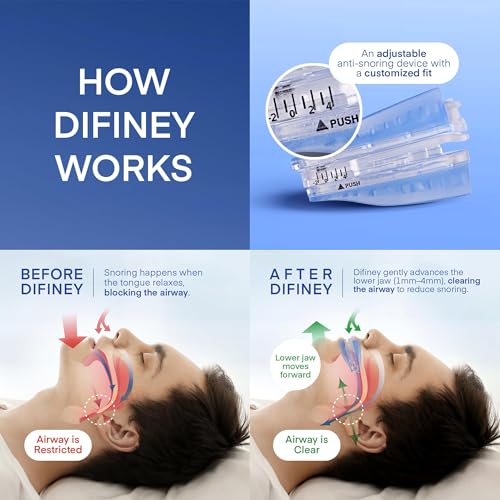 Difiney Anti Snoring Device: FDA-Cleared Snoring Solution – Adjustable Snore Stopper Mouth Guard for Men & Women – Anti Sn...