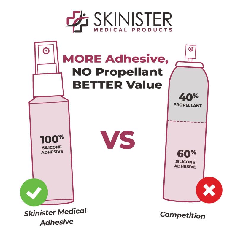 Skinister Medical Adhesive Spray – Silicone Skin Glue for Ostomy Supplies, Ileostomy, Colostomy & Urostomy, Stoma & Ostomy Bag Adhesive, Breast Forms, Condom Catheters, Prosthetics, SFX Makeup | 2oz