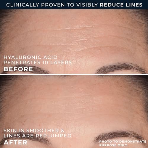 RoC Hydration+ Replumping Serum Stick, Fragrance-Free, Hydrating And Cooling Hyaluronic & Peptide Formula To Boost Elastic...