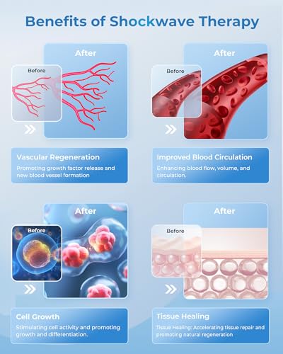 2026 Advanced Shockwave Therapy Machine, Extracorporeal Shock Wave Therapy Device for Pain Relief, ESWT Machine for Muscl...