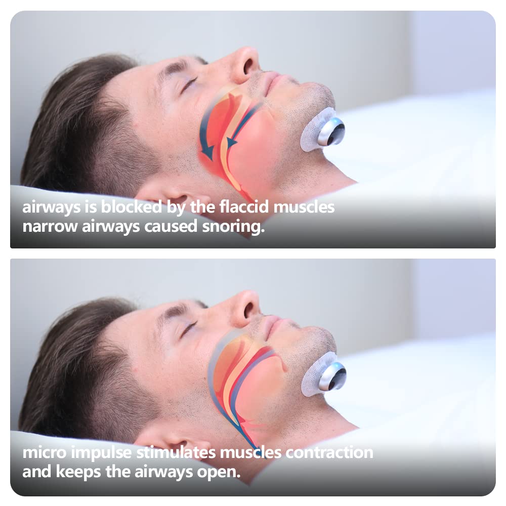 SNORE CIRCLE Smart Throat Anti Snoring Device Plus - Snore Stopper Effective Snoring Solutions Snore Reduction Sleep Aids with APP Records and Analyzes Sleep Datas