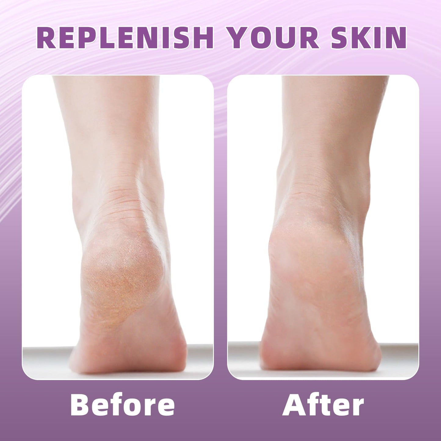 2 Pairs Silicone Socks for Dry Cracked Feet Women, Moisturizing Heel Socks, Gel Toeless Lotion Sock, Moisture Silicon Foot Sock