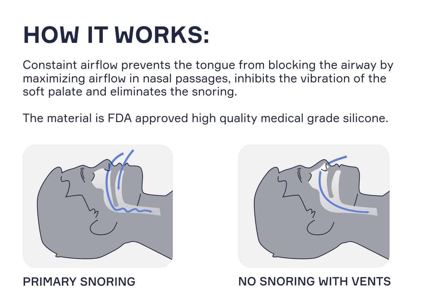 Snore Bastion Nasal Dilators for Sleeping - 12 Nasal Cones for Breathing - Nostril Opener and Soft Silicone Nose Vents for Quiet Nights and Restful Sleep - Sinus Cones