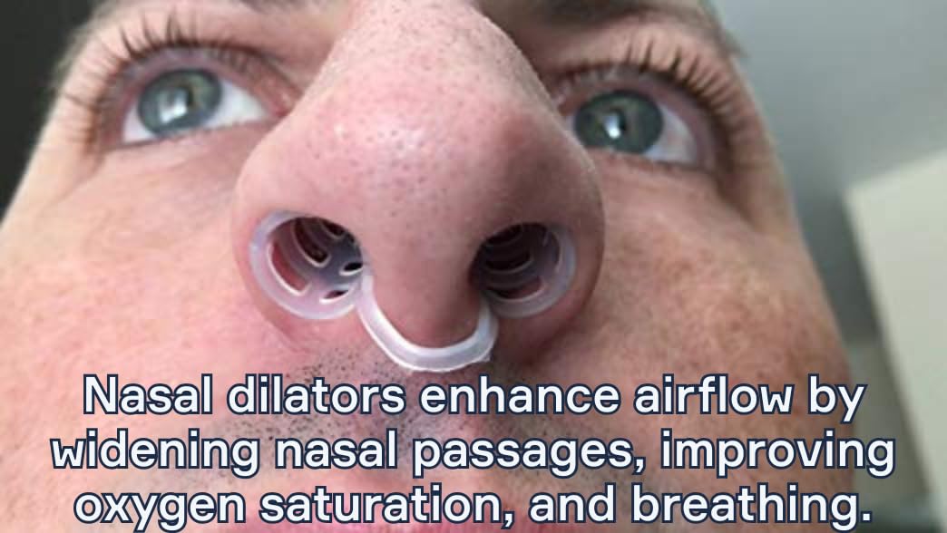 Snore Bastion Nasal Dilators for Sleeping – Set of 4 Large (L) Soft Nose Vents and Nostril Opener for Quiet Nights - Nasal Cones