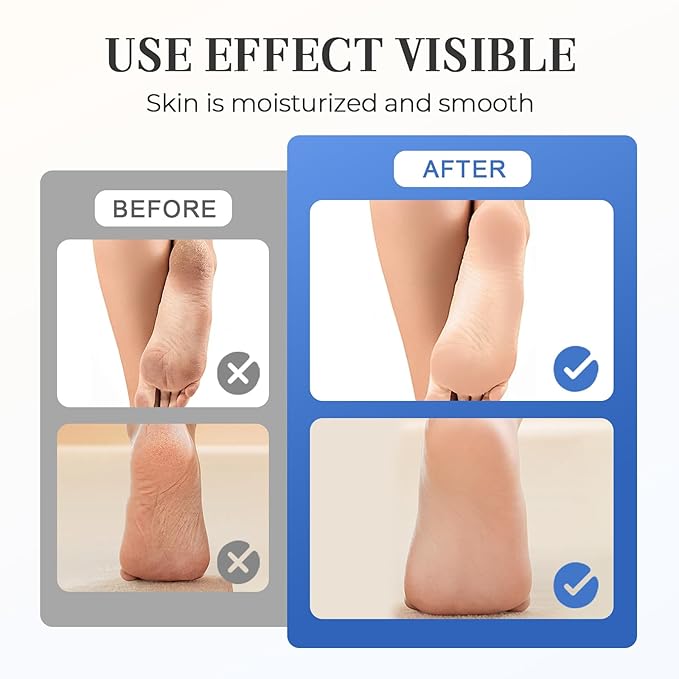Hydrating and Anti-Cracking Foot Cream, 2025 Moisturising and Relieves Cracking and Dryness Foot Cream, Hand and Foot Repair Cream for Women & Men Callused, Feet, Knee, Elbow, Hand (Pink-2PCS, #01)