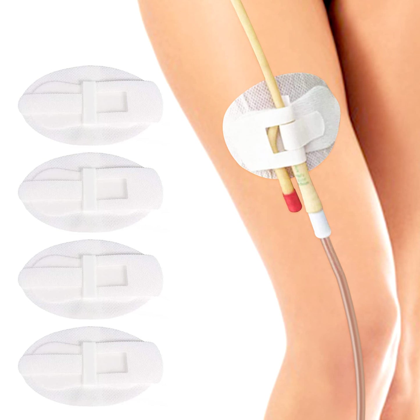 Foley Catheter Stabilization Device, Urinary Leg Bag Holder, Pack of 4